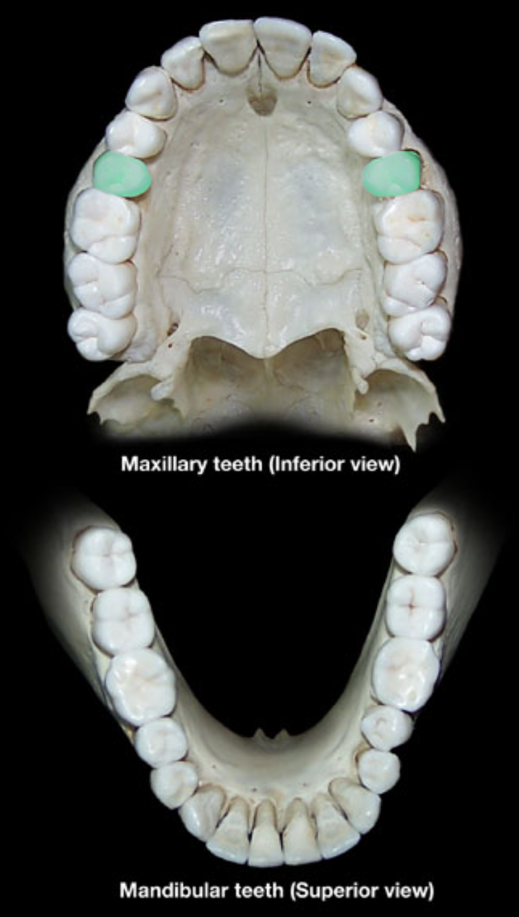 term image
