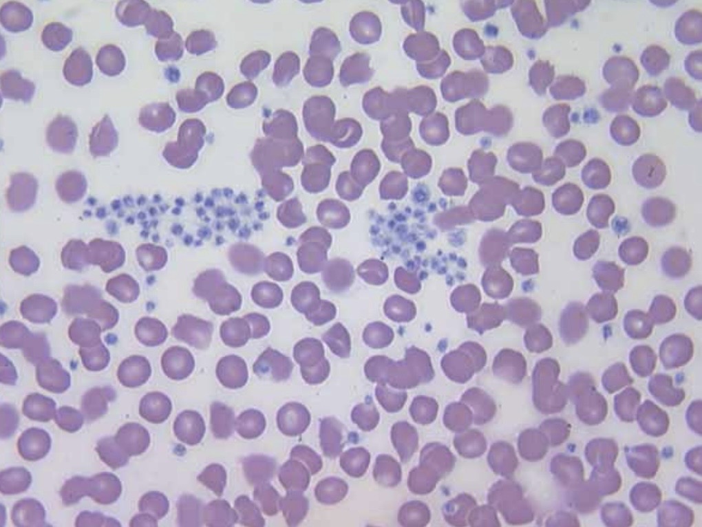 <p>Describe these platelets</p>