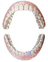 <p>mandibular left lateral incisor</p>