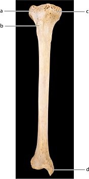 <p>Identify the bone feature labeled “d.”</p><p>a. articular surface</p><p>b. anterior crest</p><p>c. medial malleolus</p><p>d. lateral malleolus</p>