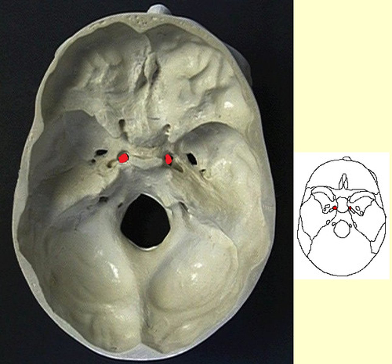 <p>ID highlighted holes</p>