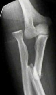 <p>bado 3 monteggia</p>