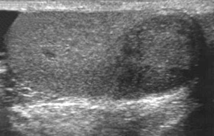 <p>What is the pathology </p>