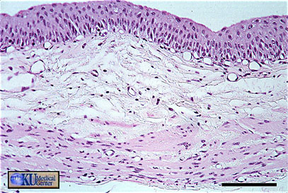 <p><span><span>What type of epithelium is found in the inner mucosa of the urinary bladder?</span></span></p>