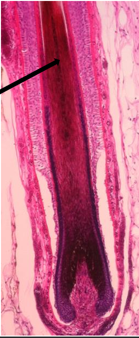 <p>what part of the hair system is this?   </p>