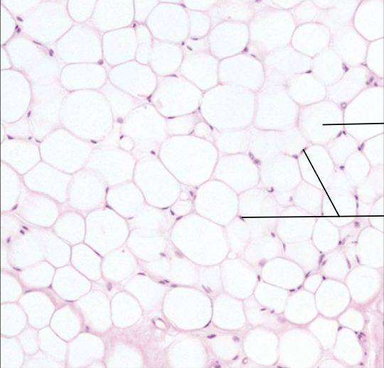 <p>What tissue?</p>