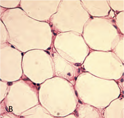 <p>yellow fatty spheres</p>
