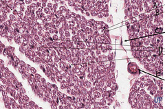 <p>What is indicated by arrow 'B' in this slide of peripheral nerve?</p>