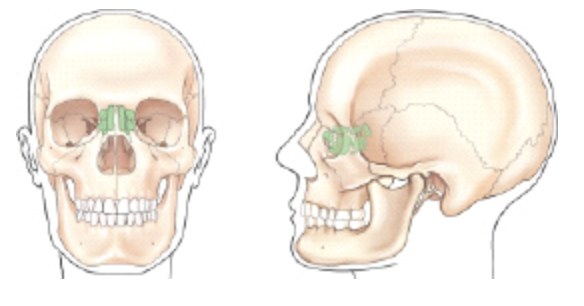 <p><span><span>Which group of sinuses is shaded (screened) in the frontal and lateral views of the illustration below?</span></span></p>