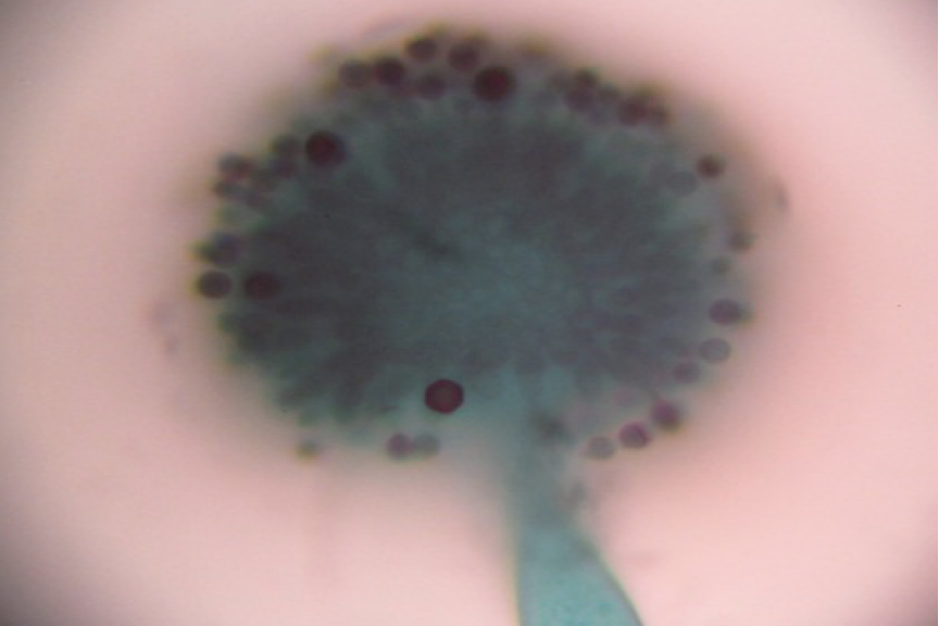 <p>What type of organism is Aspergillus niger </p>