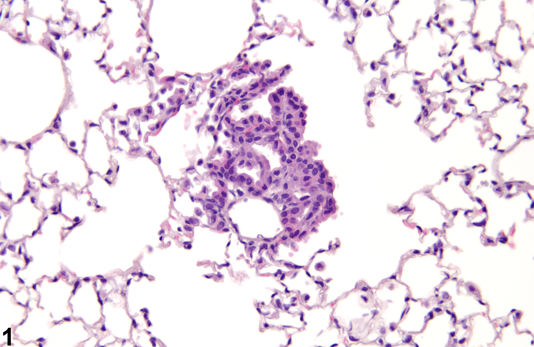 <p>must be thin so that gas can pass through and exchange via the capillaries</p>