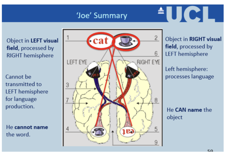 <p><span style="line-height: 22.0875px;">Corpus callosum (</span><span style="line-height: 18.6px;"><strong>bundle of nerve fibers that allow your brain's left and right hemispheres to communicate) </strong></span><span style="line-height: 22.0875px;">cut to treat epilepsy.&nbsp;Joe stares at center dot and objects are flashed either to the right side of the dot really or left </span></p><p class="Paragraph SCXW23595716 BCX8" style="text-align: left;"><span style="line-height: 22.0875px;">If object in:&nbsp;</span></p><ul><li><p class="Paragraph SCXW23595716 BCX8" style="text-align: left;"><span style="line-height: 22.0875px;">Right visual field → Left hemisphere → Can name it&nbsp;</span></p></li></ul><ul><li><p class="Paragraph SCXW23595716 BCX8" style="text-align: left;"><span style="line-height: 22.0875px;">Left visual field → Right hemisphere → Cannot name it&nbsp;</span></p></li></ul><p class="Paragraph SCXW23595716 BCX8" style="text-align: left;"><span style="line-height: 22.0875px;">Demonstrates hemispheric specialisation.&nbsp;</span></p>