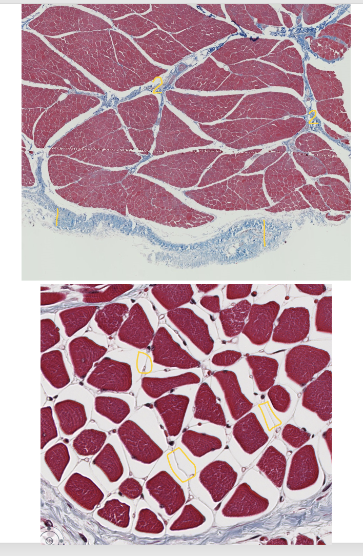 <p><span style="font-family: "Calibri Light";">Skeletal muscle has three CT layers: epimysium, perimysium, and endomysium.<br><br>ID the numbered CT layers.</span></p>