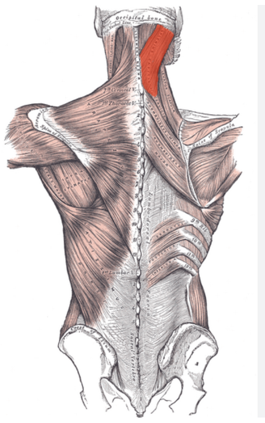 <p>Identify the highlighted muscle </p>