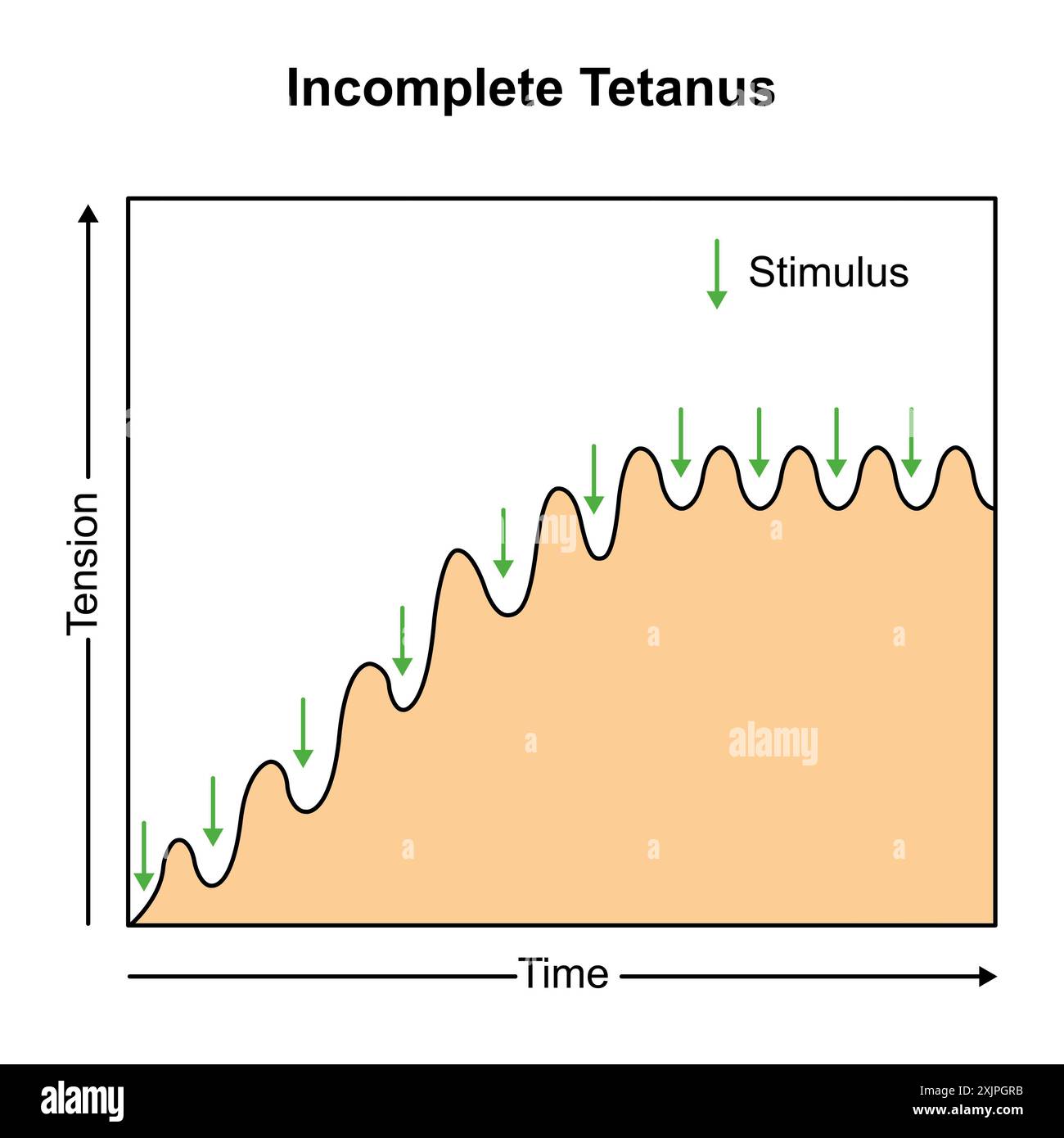 <p>Incomplete tetanus</p>