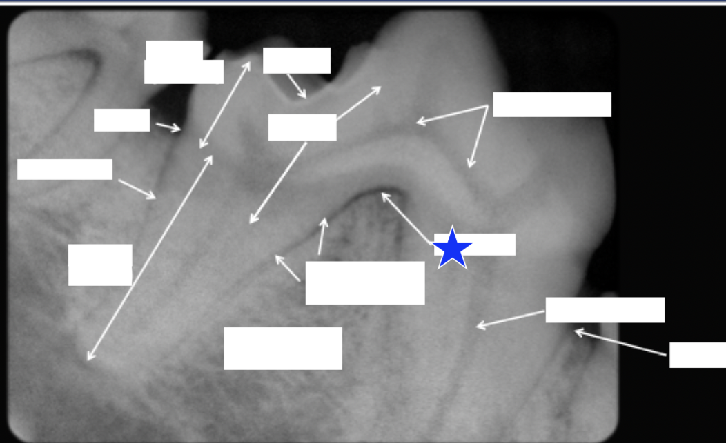 <p>What part of the tooth is indicated by the star?</p>