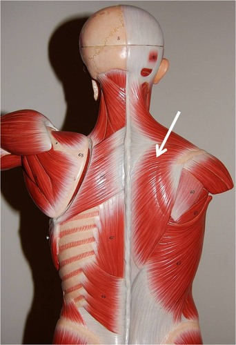 <p>What muscle is this?</p>