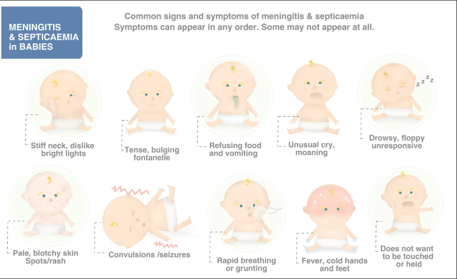 <p></p><ol><li><p><span style="color: red;">NO <strong>nuchal rigidity!!</strong> (neck is supple/flexible)</span></p></li><li><p><span style="color: rgb(169, 144, 21);"><strong>weak cry</strong></span></p></li><li><p><span style="color: rgb(115, 149, 17);"><strong>bulging fontanel</strong></span> (LATE sign)</p></li><li><p>poor <span style="color: rgb(25, 177, 46);"><strong>feeding/vomit</strong></span></p></li><li><p>poor <span style="color: rgb(24, 161, 173);"><strong>muscle tone</strong></span></p></li><li><p>poor <span style="color: rgb(119, 113, 246);"><strong>suck</strong></span></p></li><li><p><span style="color: rgb(20, 17, 199);"><strong>fever or hypothermia</strong></span></p></li></ol><p></p>