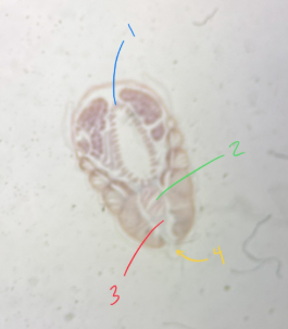 <p>Phylum<br>Subphylum</p>