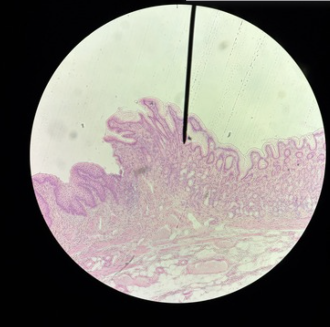 <p>Identify structure &amp; which side</p>
