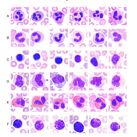 <p>Never Let Monkeys Eat Bananas</p><ul><li><p>Neutrophil: 55-70%</p><ul><li><p>A: segmented neutrophils</p></li><li><p>B: band neutrophils</p></li></ul></li><li><p>C: Lymphocyte: 20-40%</p></li><li><p>D: Monocyte: 2-8%</p></li><li><p>E: Eosinophil: 1-4%</p></li><li><p>F: Basophil: 0.5-1%</p></li></ul><p></p>