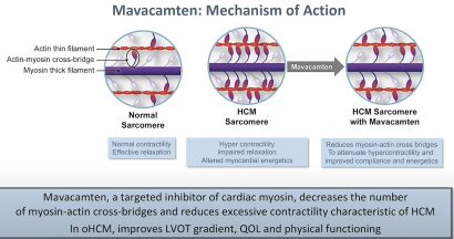 <p>MOA of Mavacamten / Camzyos ?</p>