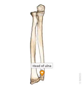 <p>Name the specific part of the bone in color</p>