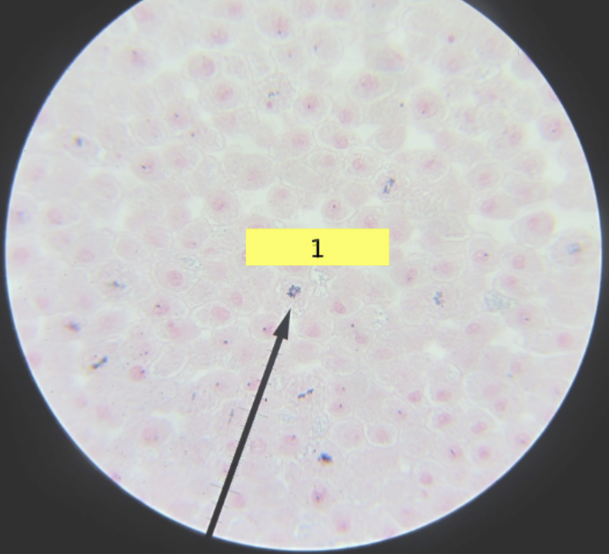 <p>what stage of mitosis?</p>