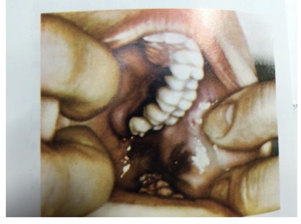 <p>CHẨN ĐOÁN</p>