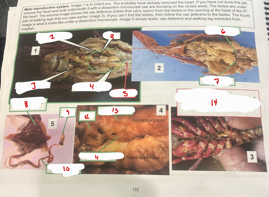 <p>Male Reproductive System</p>