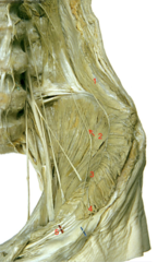 <p>Identify the structure at #1</p>