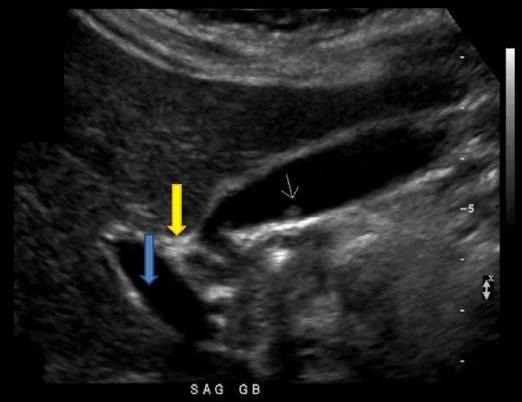 <p>What structure is indicated by the yellow arrow?</p>