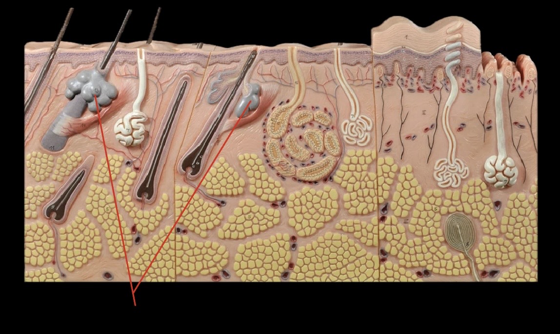 <p>What gland is this?</p>