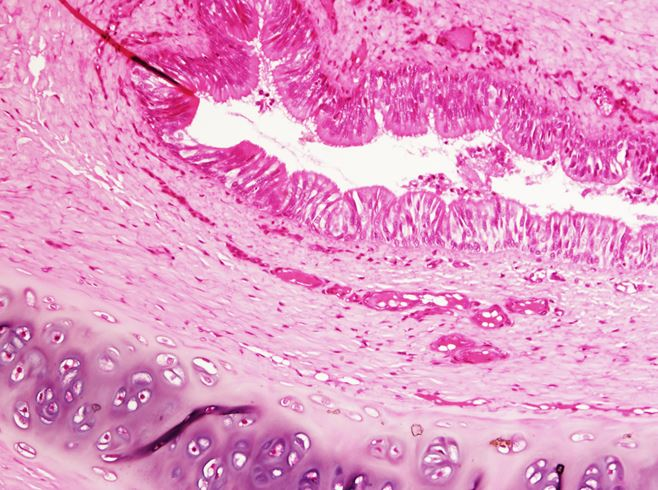 <p>Tiêu bản gì ?</p>