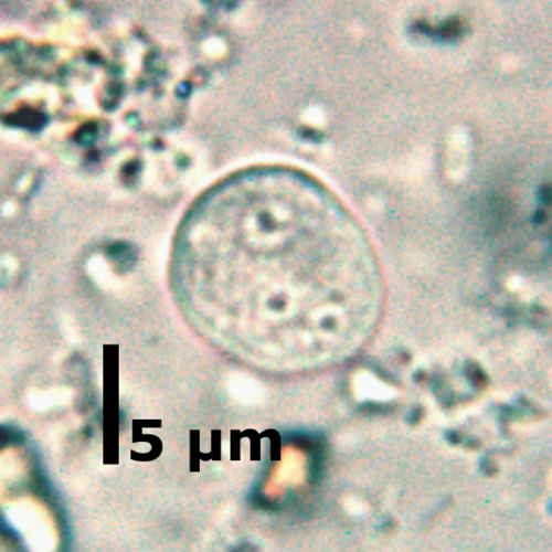 <p>15-12 um, 1-4 nuclei, irregular clumped karyosome, <u>no PC</u>, oval</p>