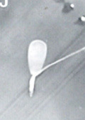 <p>What is this? Normal or abnormal sperm?</p>