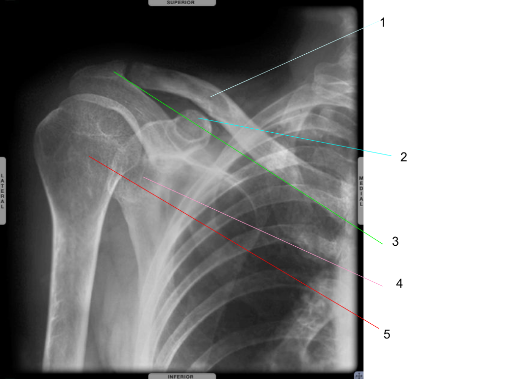 <p>what is #4 pointing at?</p>