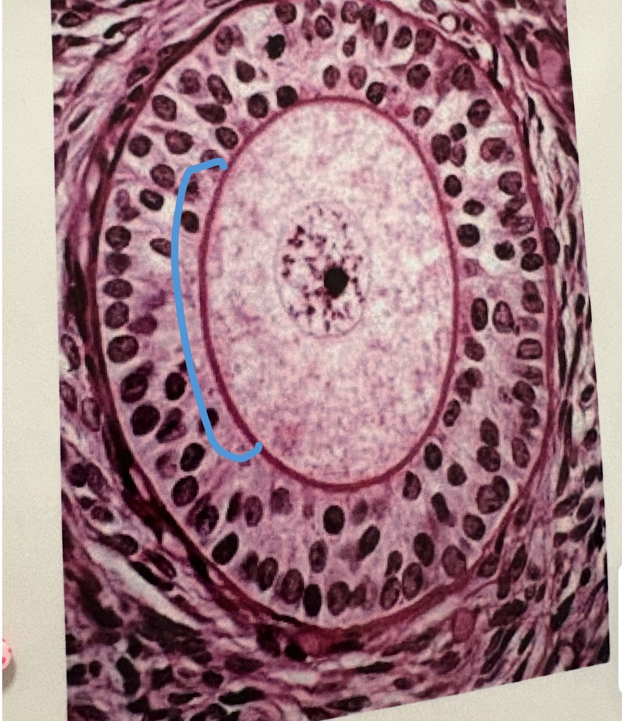 <p>glycoprotein-rich extracellular layer around oocyte </p>