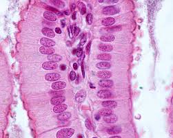 <p>what <strong>shape</strong> of epithelial tissue does this image display?</p>