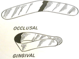 <p>small side — </p><p>large side —</p>