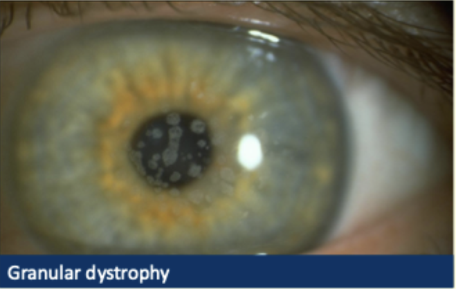 <p>Describe + give diagnosis </p>