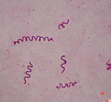 <p>A large helical bacterium commonly found in stagnant freshwater environments</p><p>Known for its spiral shape and its role in its habitat.</p><p>Plays a role in decomposition and indicates water quality. Its presence suggests low oxygen conditions and high organic matter content</p><p>5-8 um in diameter</p><p>Has a bipolar flagellum which allows it to move in a corkscrew motion</p><p>Gram negative with a cell wall with an outer membrane</p><p>Helps with food production, preservation, health benefits</p>