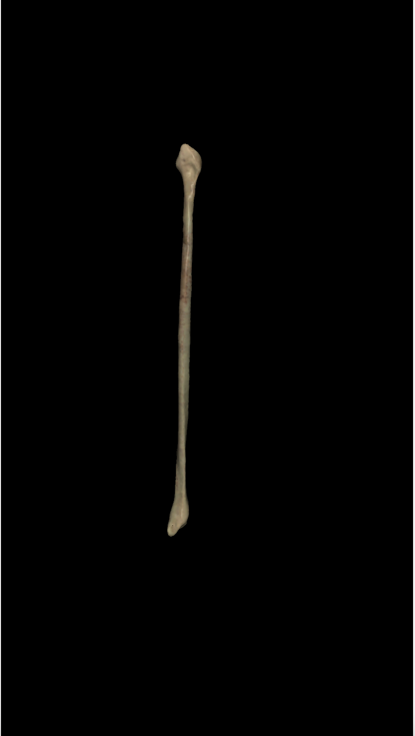 <p>left or right fibula? (posterior view)</p>