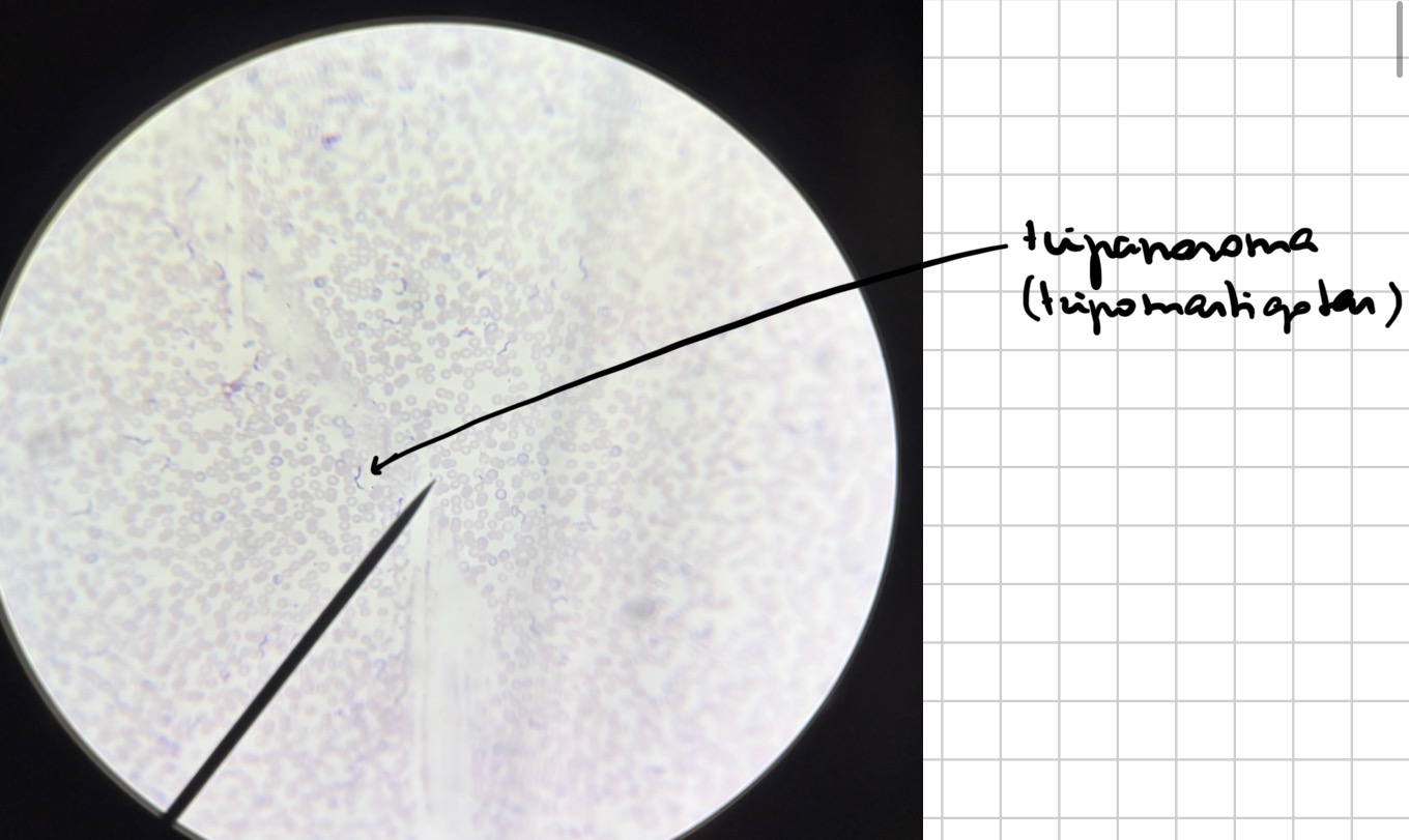 <p>Tripanosoma krayjyje - trypanosoma (tripomastigotas)</p>