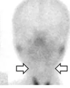 <p>what does this salivary test indicate </p>