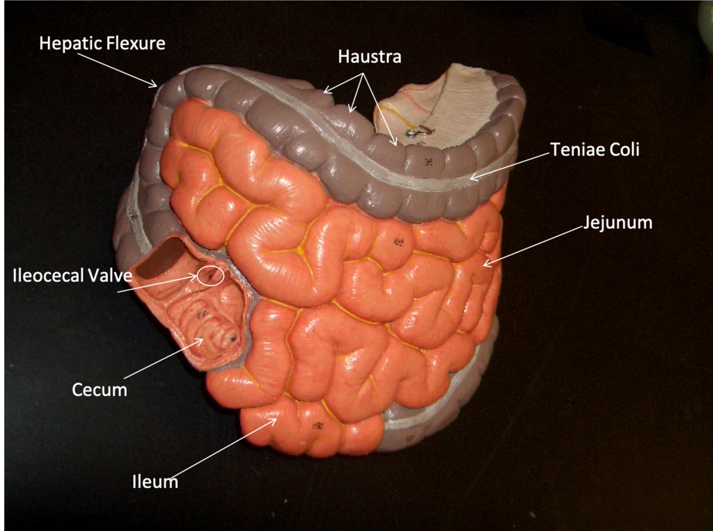 <p>Bumps</p>