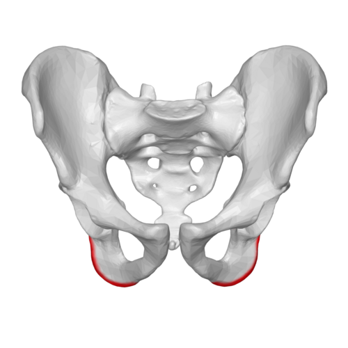 <p>Name the specific part of the bone in color</p>