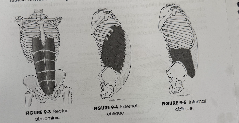 <p>most commonly recognized abdominal muscle</p>