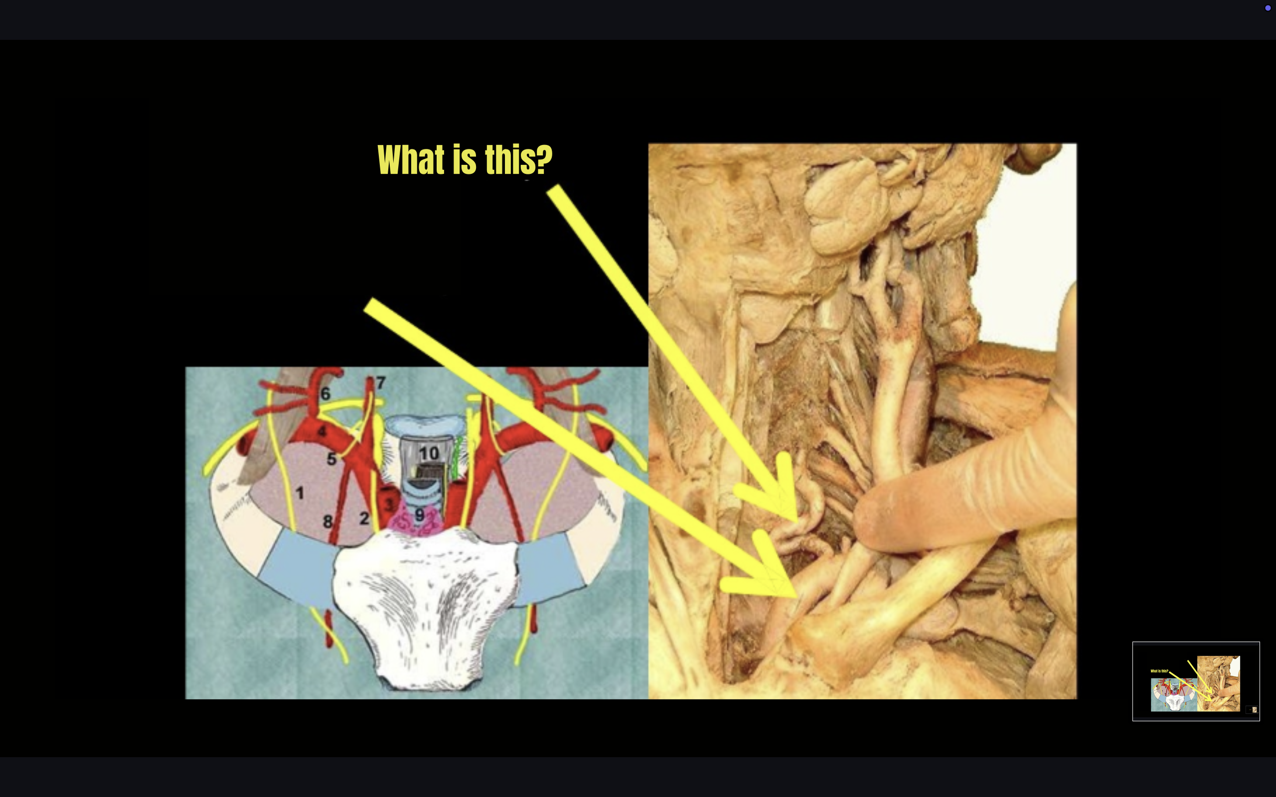 term image