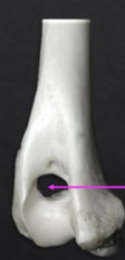 <p>What is this?</p>